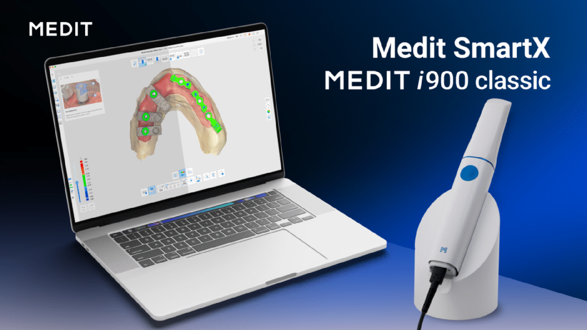 Medit SmartX Transforms All-on-X Implant Dentistry | IT Tech Pulse
